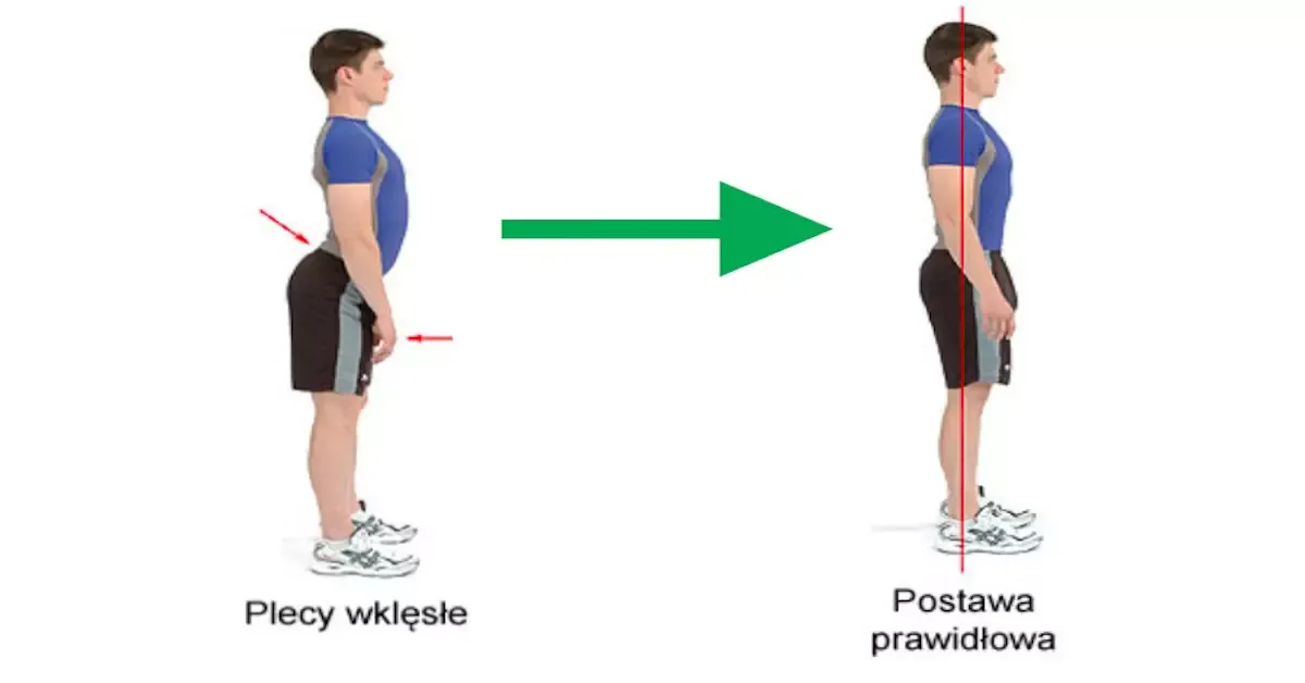 prawidłowa postawa skolioza ćwiczenia