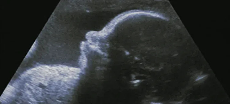 rozw&oacute;j m&oacute;zgu płodu 27 tydzień