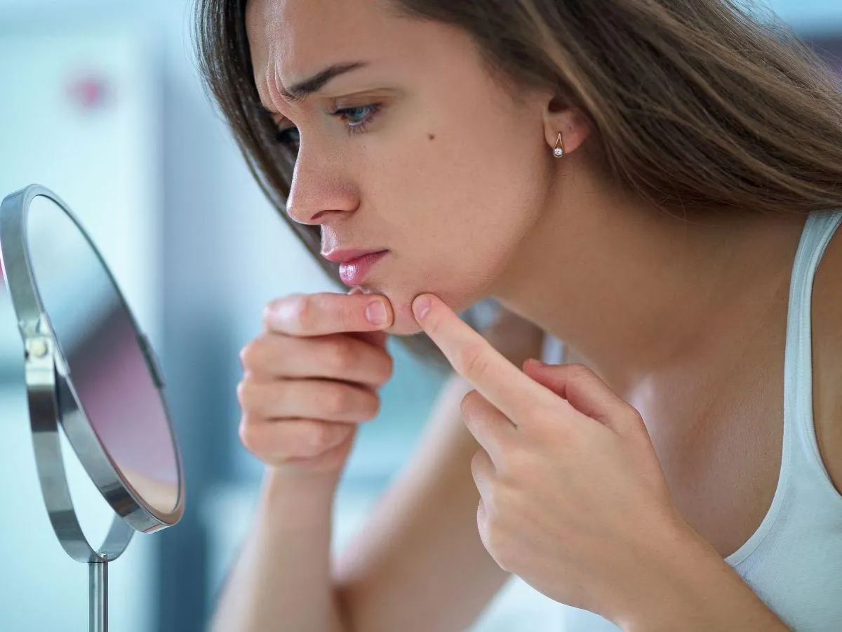 Zmarszczki na czole i frustracja. Kobieta zastanawia się, jak przestać wyciskać pryszcze, patrząc w lustro.