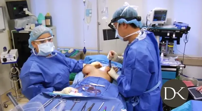 Zdjęcie Kiedy puszcza mięsień po operacji biustu? Ważne informacje