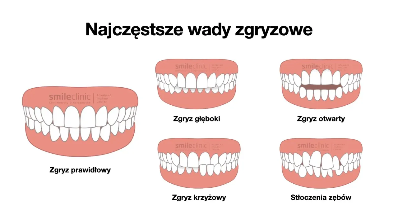 Zdjęcie Wnętrostwo i zgryz u psa: wady dyskwalifikujące. Co musisz wiedzieć?