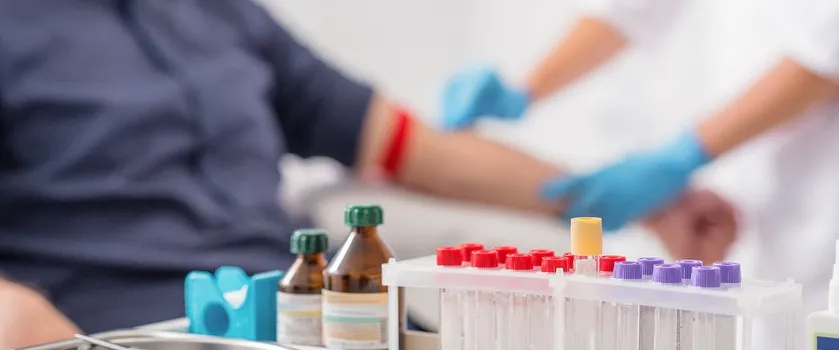 Zdjęcie Jakie badania na toczeń? Kluczowe testy, które mogą uratować zdrowie