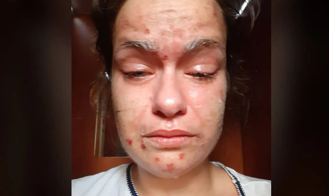 Osoba płucząca twarz po kontakcie z gazem pieprzowym