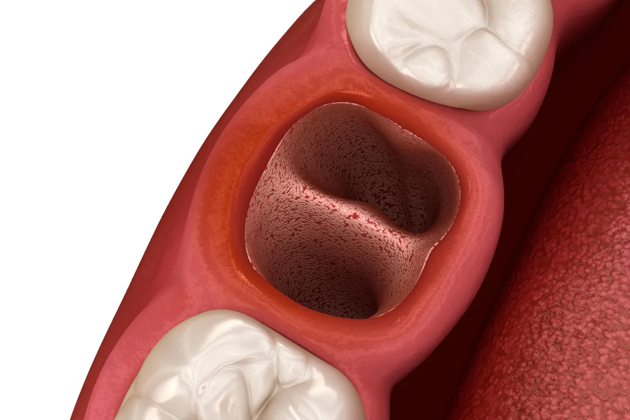 suchy zębod&oacute;ł grafika