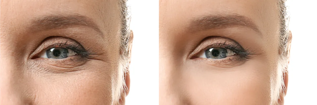 skóra przed i po boosterze rozświetlającym