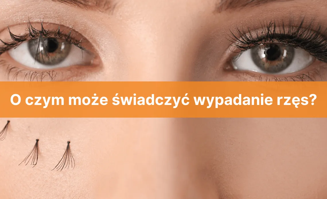 Przedłużane rzęsy wypadanie przyczyny