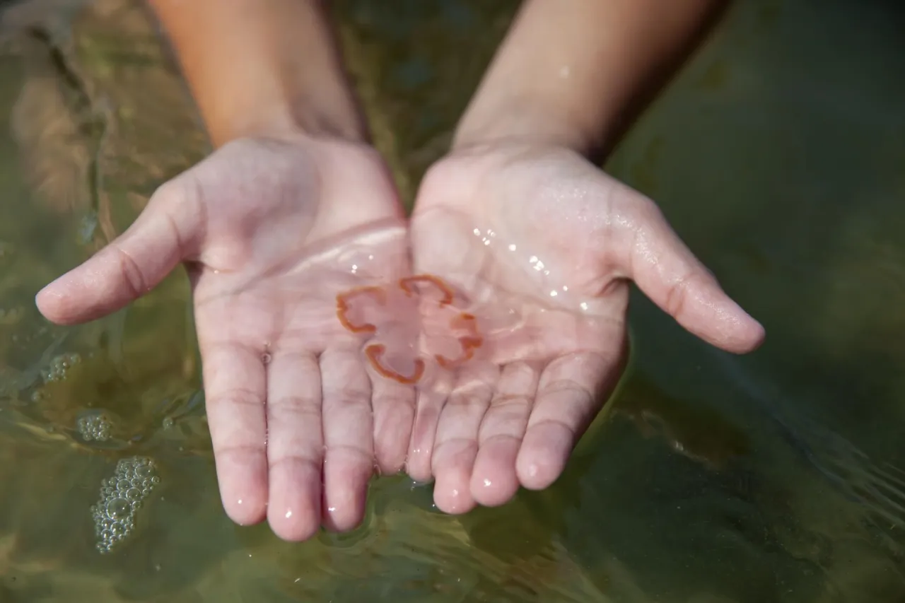 Oparzenie meduzy objawy na skórze