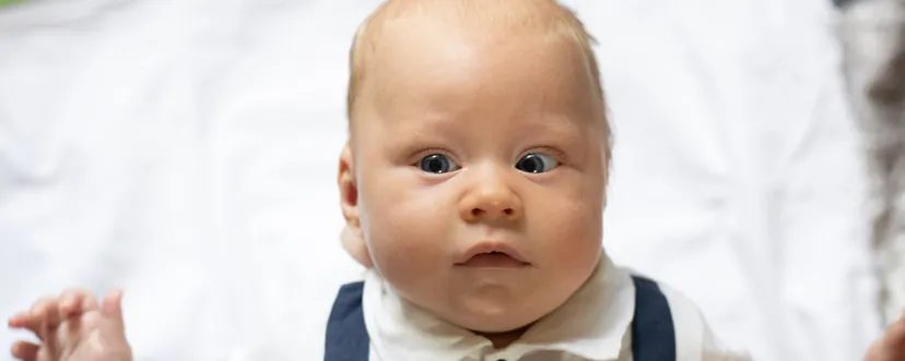 niemowlę z zezem zbieżnym i rozbieżnym