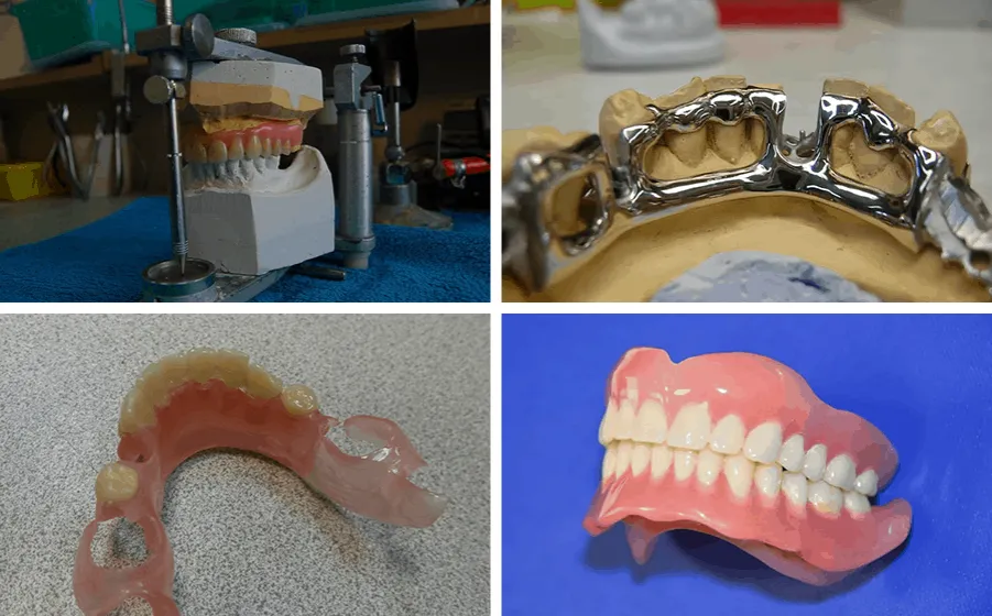 naprawa protezy zębowej w pracowni protetycznej