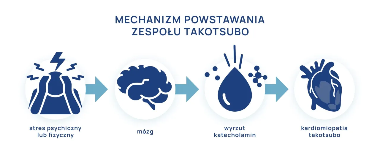 Syndrom złamanego serca a zawał serca różnice