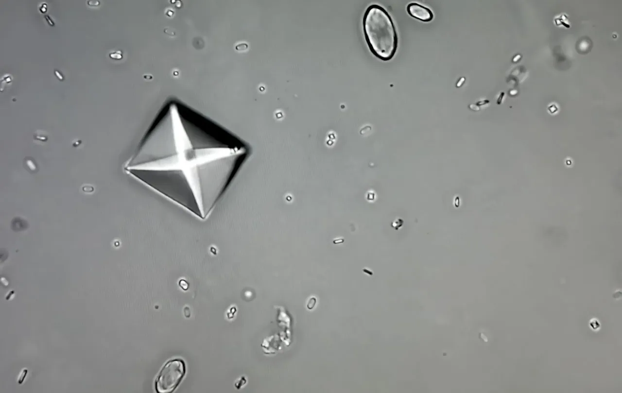 neutralizacja szczawian&oacute;w wapń