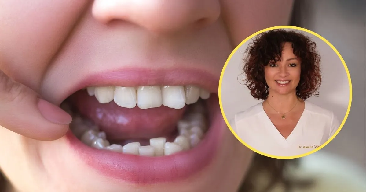 Zdjęcie Jak mieć proste zęby bez aparatu? Skuteczne metody i porady