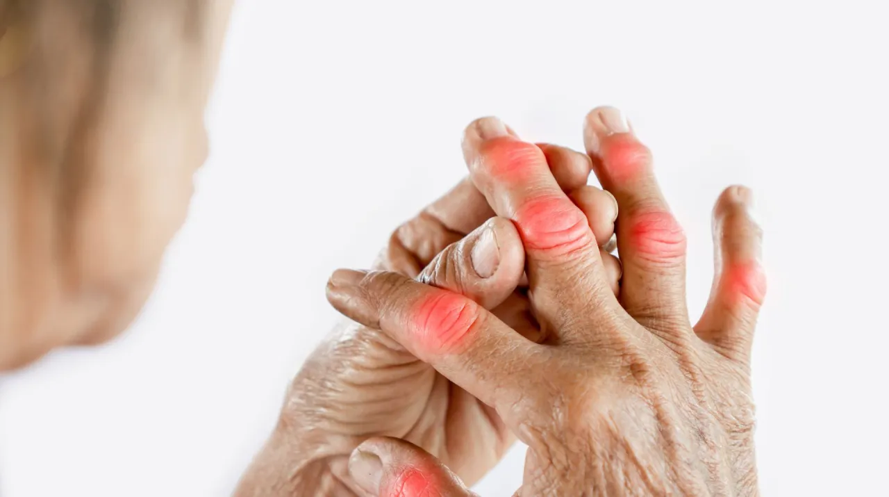 Maść na ból stawów dna moczanowa