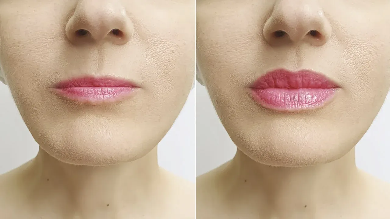 Powiększone usta bez papierosa
