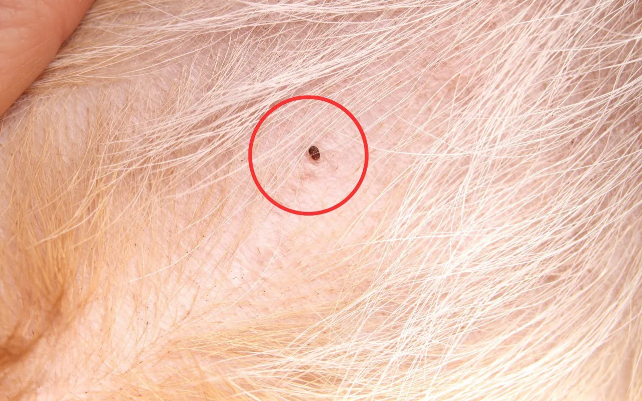 kleszcz w sk&oacute;rze vs pieprzyk vs strupek zdjęcia