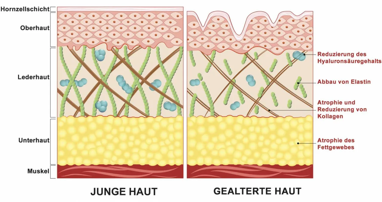 Gesichtshautalterung Kollagen Elastin