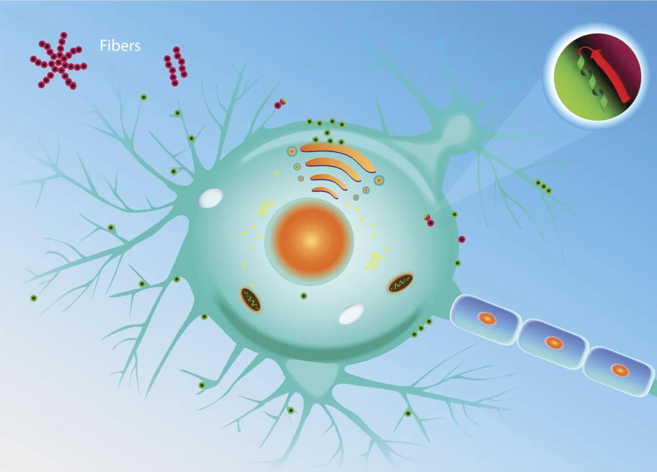 Zesp&oacute;ł Gerstmanna-Str&auml;usslera-Scheinkera grafika medyczna