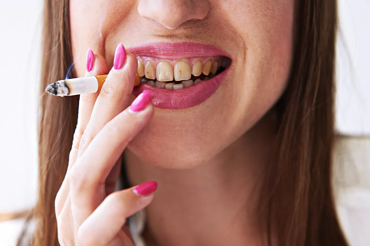 Wpływ palenia na gojenie ran w jamie ustnej