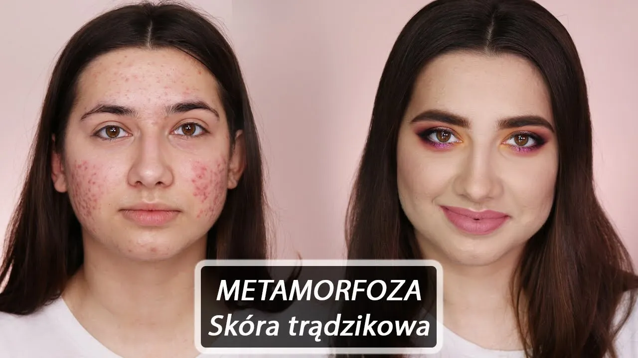 Jak zamaskować pryszcza makijażem krok po kroku