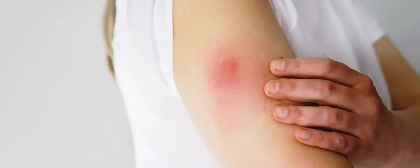 Objawy poszczepienne u dziecka