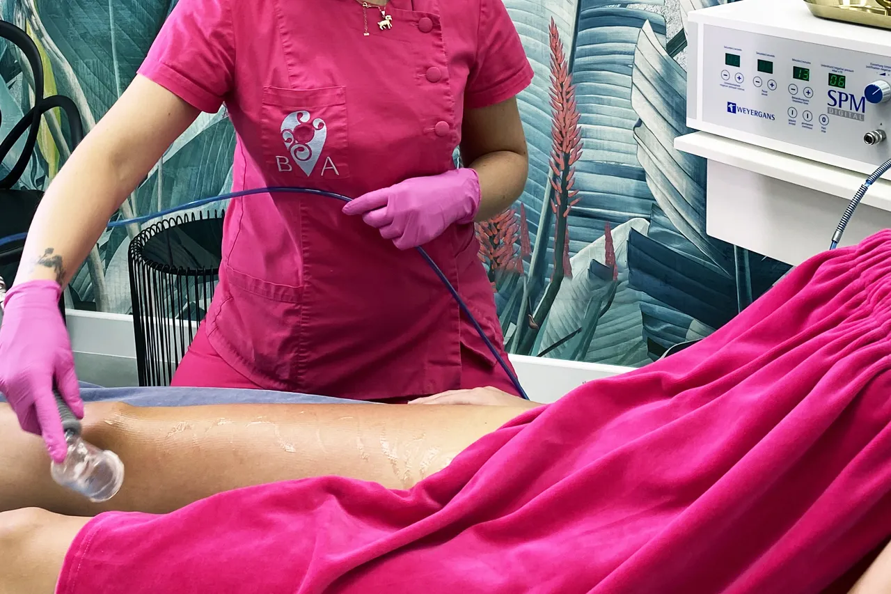Zabieg endermologii, który może pomóc jak pozbyć się cellulitu w tydzień. Kosmetolog wykonuje masaż podciśnieniowy na udzie.