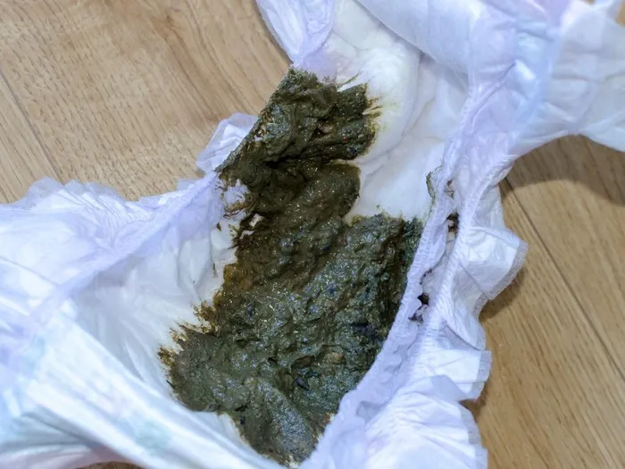 Zdjęcie Jak wyglądają kupki przy ząbkowaniu? Co powinno niepokoić rodziców?