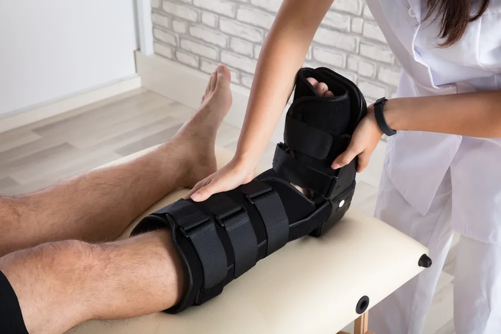 Zdjęcie Ile trwa rehabilitacja po złamaniu kostki bocznej? Poznaj szczegóły