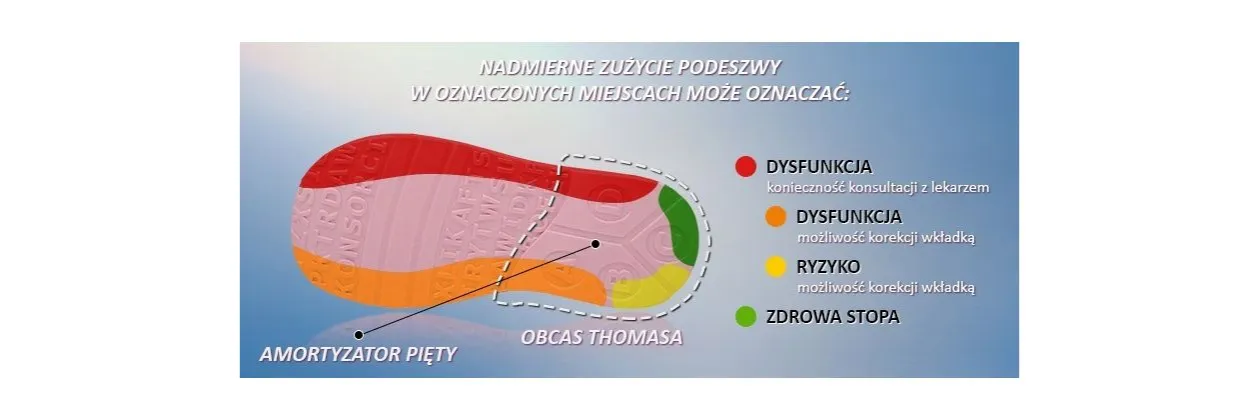Zdjęcie Obcas Thomasa dla kogo? Dowiedz się, jak może pomóc Twojemu dziecku