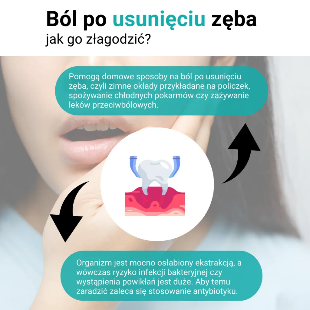 Zdjęcie Jak szybko złagodzić ból dziąsła przy zębie – domowe sposoby i porady ekspertów
