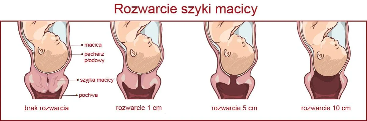 Zdjęcie Rozwarcie 1 centymetr: ile czasu zostało do porodu - przewodnik mamy