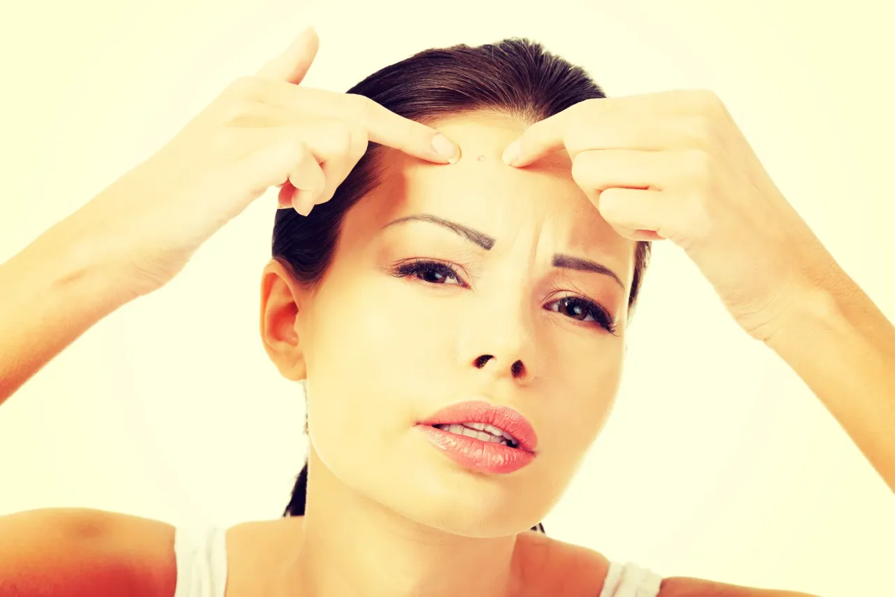 Preparaty apteczne na trądzik bez recepty