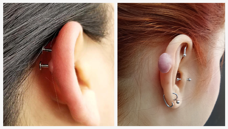 czas gojenia kolczyków w uchu grafika