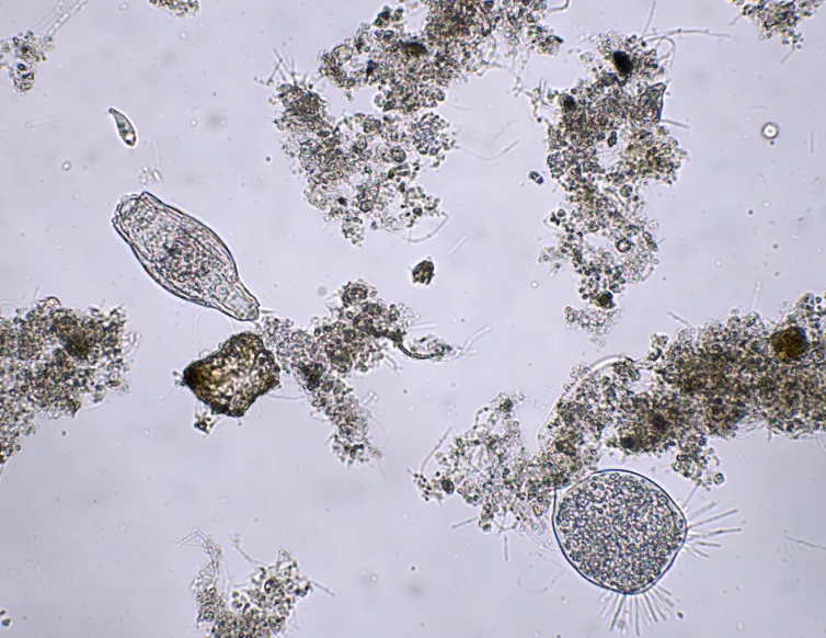 osad czynny pod mikroskopem