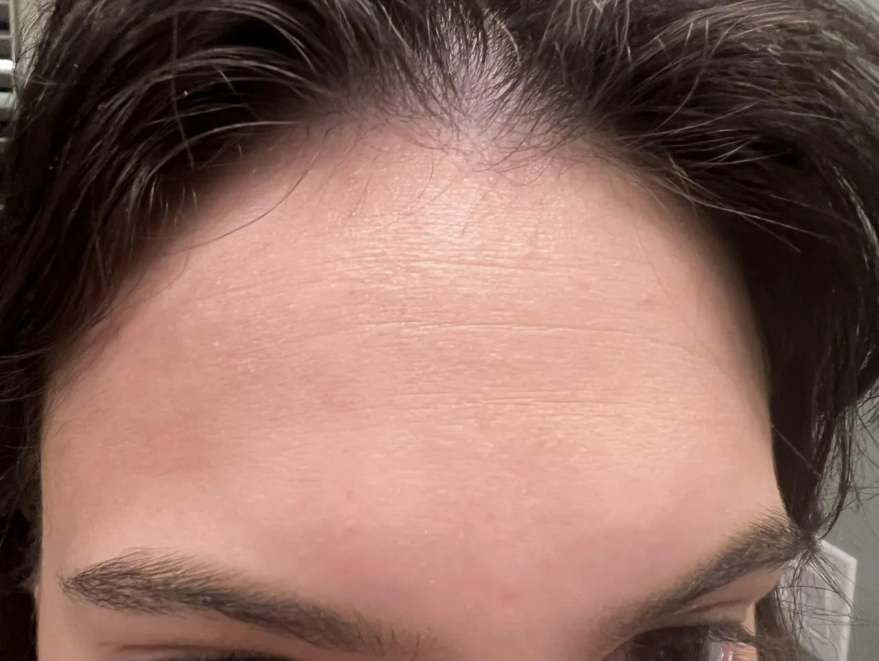 peptydy Matrixyl 3000 działanie schemat