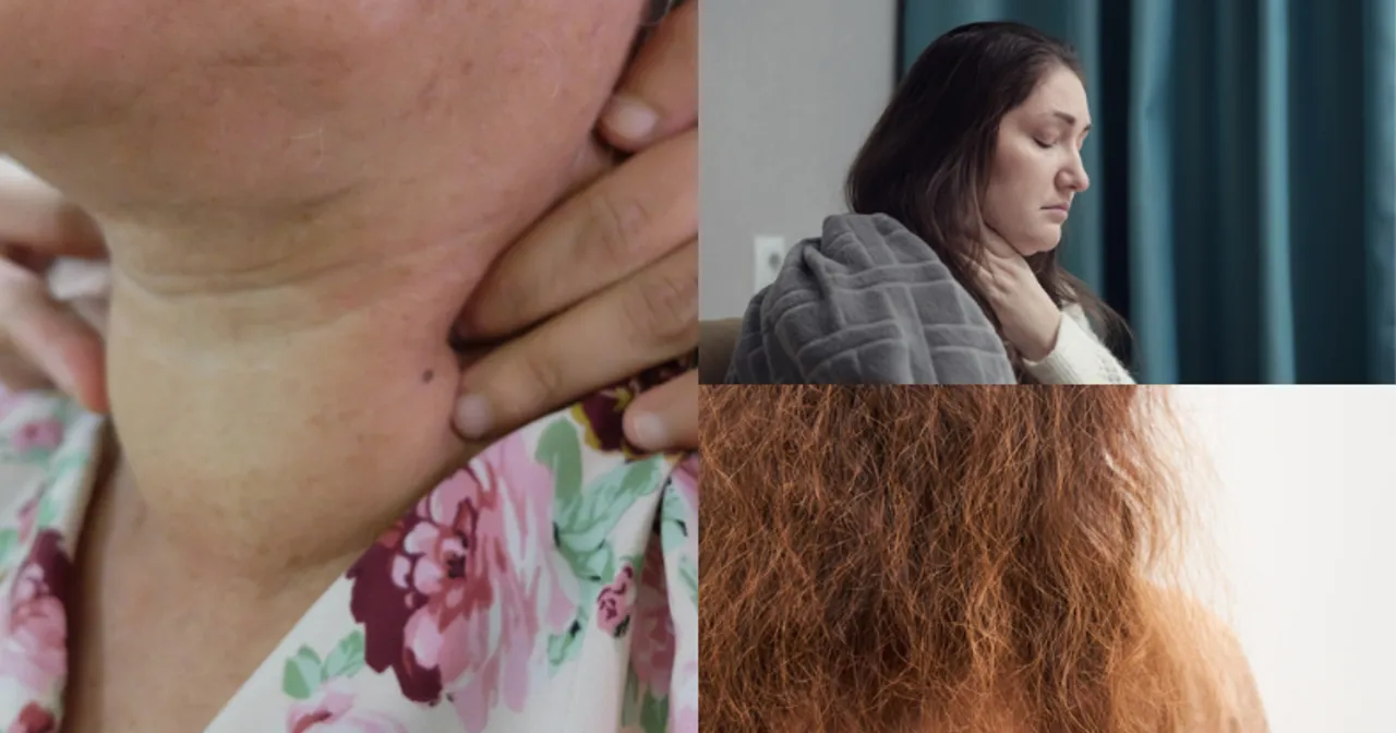 Test jodynowy na sk&oacute;rze mit