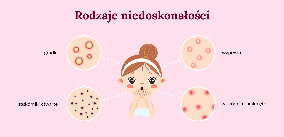 rodzaje niedoskonałości skóry infografika