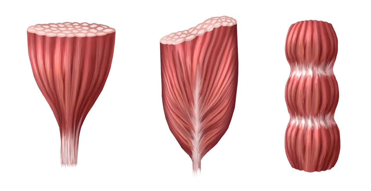 Mikrouszkodzenia wł&oacute;kien mięśniowych pod mikroskopem, schemat DOMS