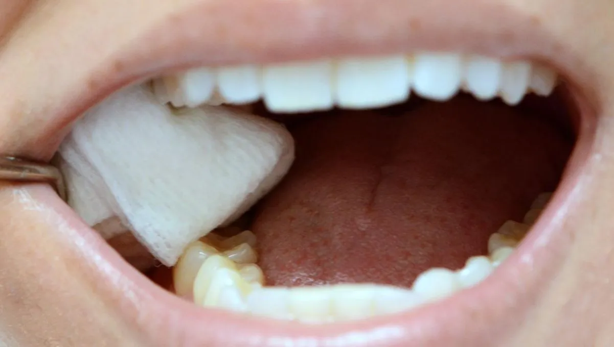 Post tooth extraction care tips