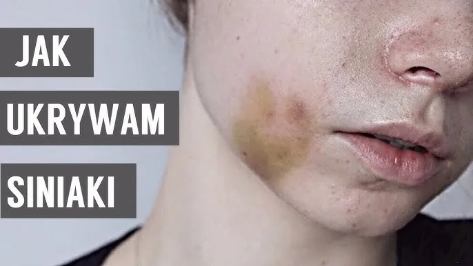 jak ukryć siniaka makijażem krok po kroku