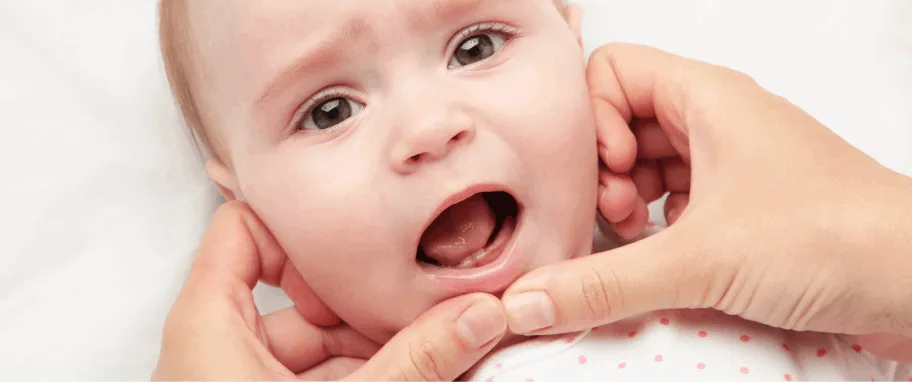 Zdjęcie Jak wyglądają dziąsła niemowlaka przy ząbkowaniu – zdjęcia i objawy
