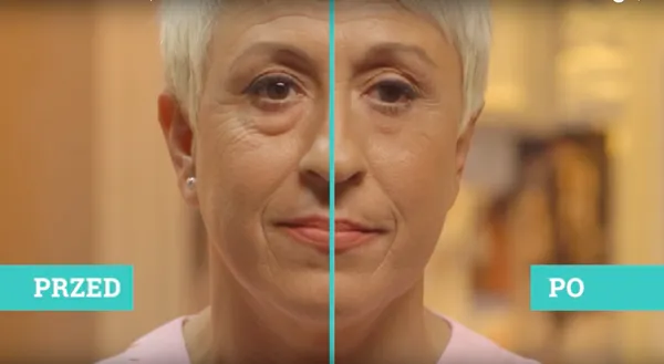 krem pod oczy na worki i cienie przed i po