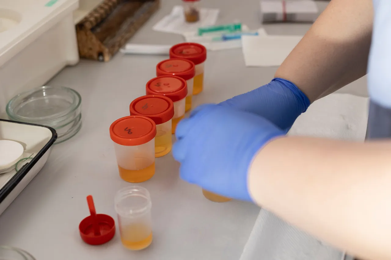 Osoba opisująca pojemnik na mocz markerem