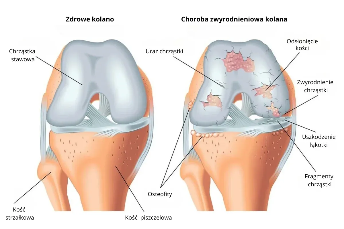 Anatomia stawu kolanowego