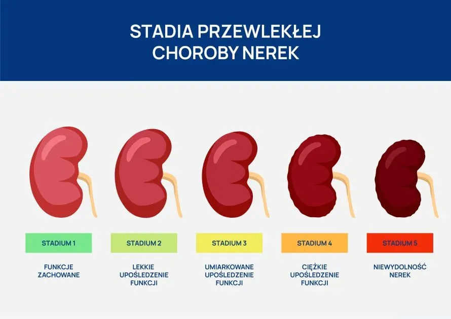 objawy chor&oacute;b nerek infografika