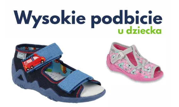 Buty dla dziecka z wysokim podbiciem przykłady