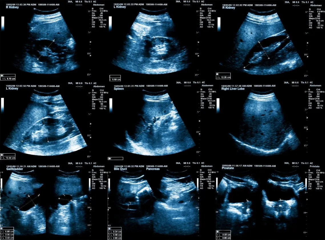 Trzustka zdrowa i chora - por&oacute;wnanie