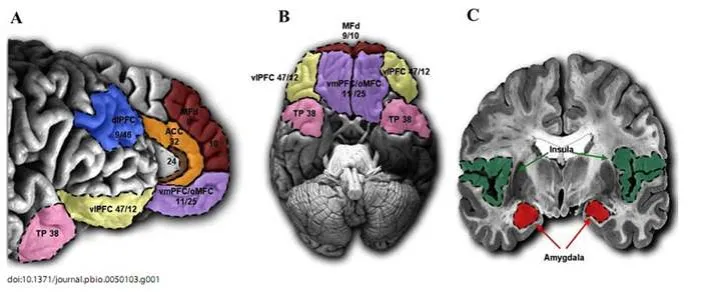 różnice mózg autyzm choroba psychiczna