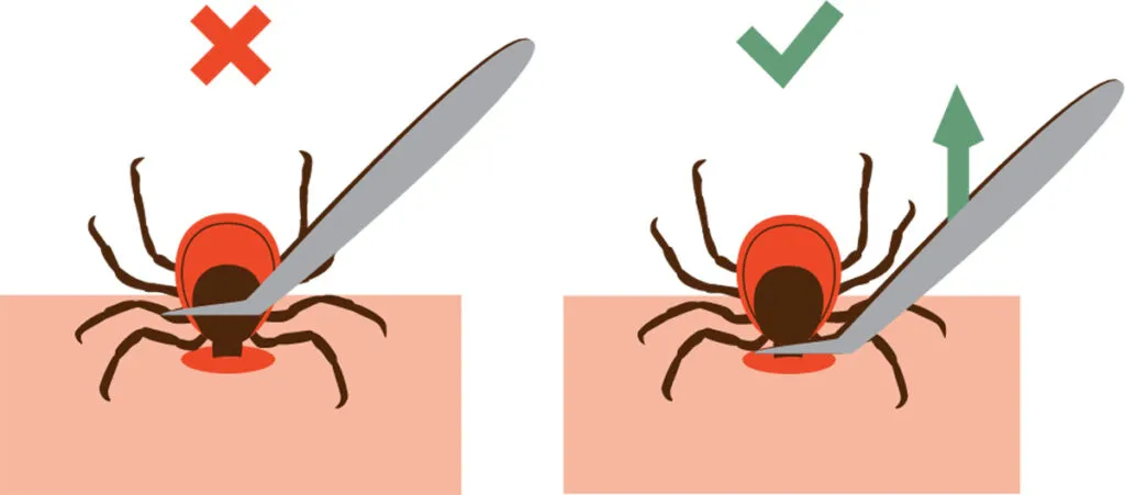 Usuwanie kleszcza u psa krok po kroku