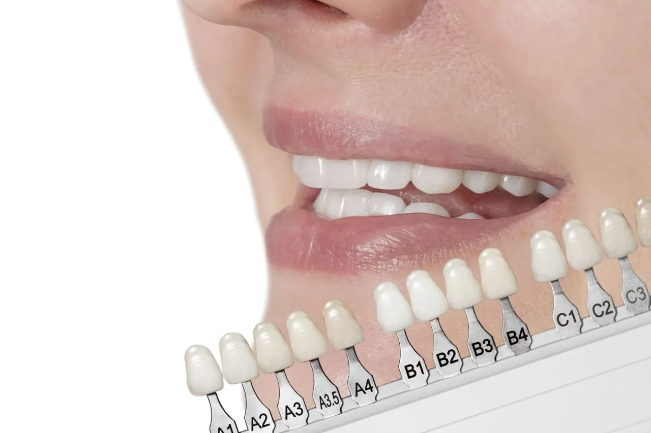 Uśmiech B2 naturalny efekt