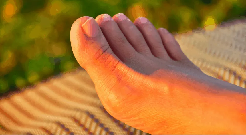 haluksy przyczyny i profilaktyka